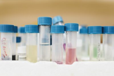 Peste pulmonaire en Sibérie : une laborantine de l&rsquo;Institut anti-peste d&rsquo;Irkoutsk décède, près de 200 personnes en quarantaine